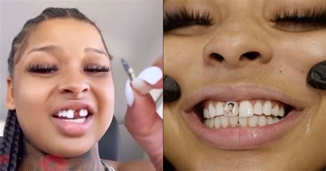 blueface girlfriend with missing tooth|Chrisean Rock’s Missing Tooth: What Really。